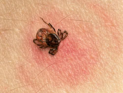 borrelia img