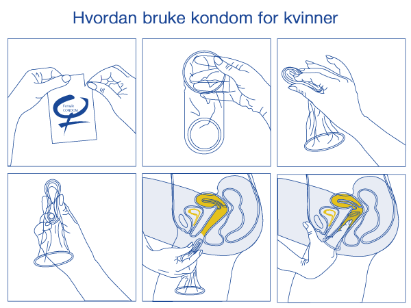 Hvordan bruke kondom som prevensjon for kvinner