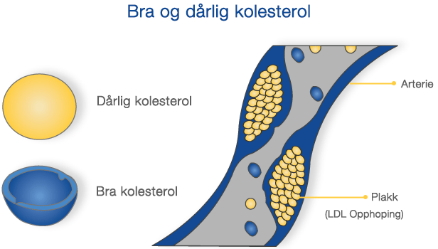 Bra (HDL) vs Dårlig (LDL) kolesterol