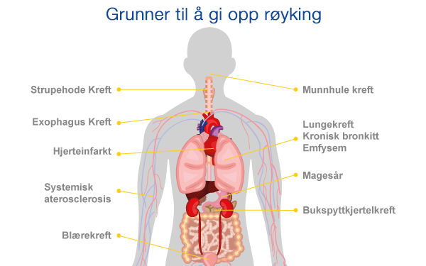 Røykeslutt